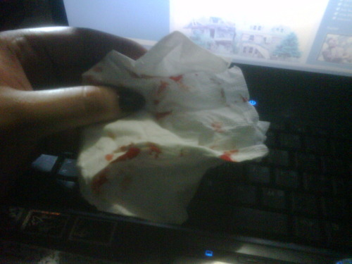 This happened to my cleveage ppiercing… O.O I doesn’t even hurt, it just started to bleed.
