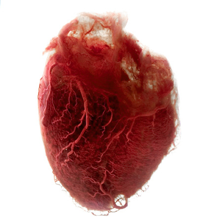 anthrax-letters:<br><br>This human heart has had the fat and extra tissue removed, leaving pure angel-hair blood vessels to make up its shape.<br>