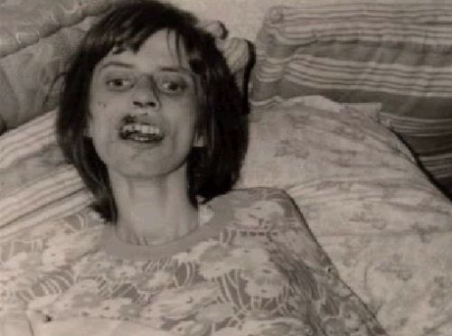 anneliese michel exorcism. Anneliese Michel (1952–1976)
