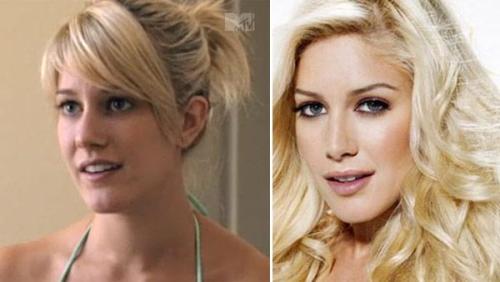 before and after of heidi montag. heidi montag before and after