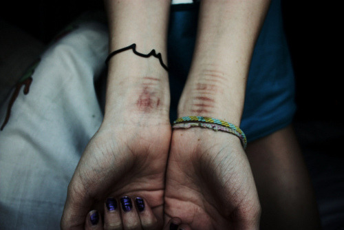Minhas cicatrizes lembram-me que meu passado é real.
Papa Roach